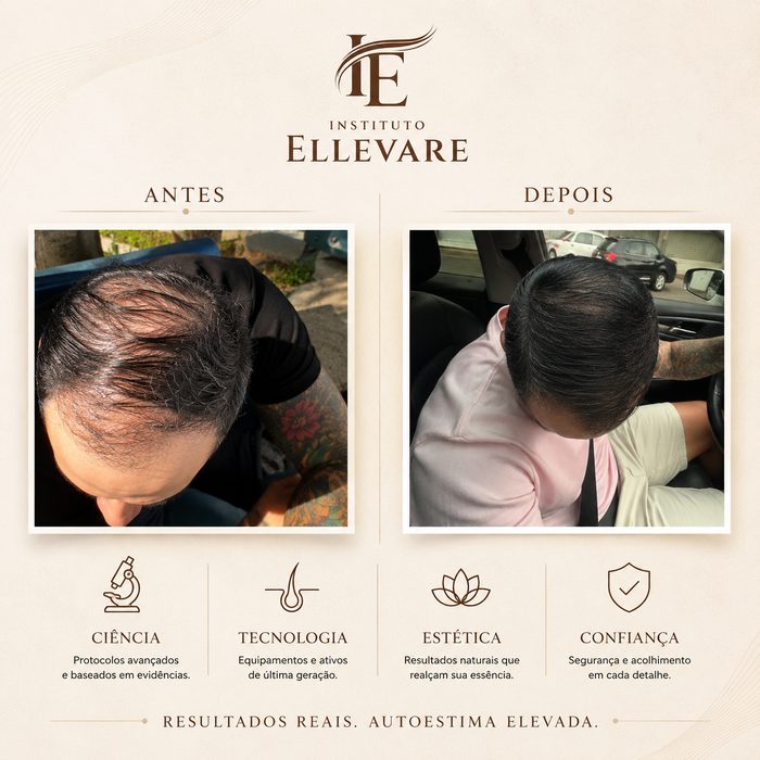 Resultado antes e depois de tratamento capilar no Instituto Ellevare